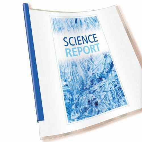 Avery Sliding Bar Report Covers Clear Cover Assorted Bars 3pk - 47314 - Clearance Sale